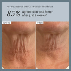 Alpha-H Retinol Reboot Exfoliating Body Treatment with 8% Glycolic Acid 2% Lactic Acid + 1% Encapsuladed Retinol