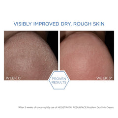 NEOSTRATA Resurface Problem Dry Skin Cream, 100 g