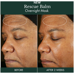 RéVive Rescue Balm Overnight Mask 75ml
