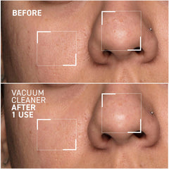 Dr. Brandt Pores No More Vacuum Cleaner 1.0oz