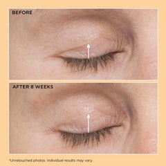 Perricone MD Neuropeptide Eyelid Lift Serum