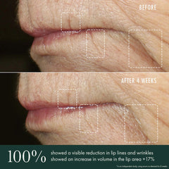 RéVive Skincare Advanced Lip Perioral Serum Targeted Vertical Line Filler 15ml