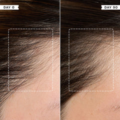Density Preserving Scalp Drops 85ml