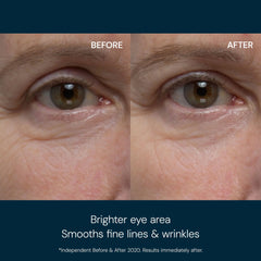 Elemis Pro-Collagen Eye Revive Mask (15ml)
