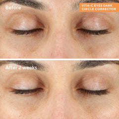 Murad Vita-C Eyes Dark Circle Corrector 0.5 oz