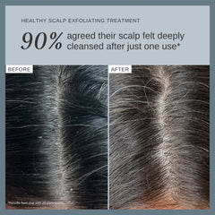Alpha-H Healthy Scalp Exfoliating Treatment with Australian Desert Lime 100ml
