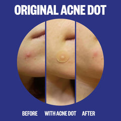 Peace Out Acne Salicylic Acid Day & Night Duo (20 Dots)