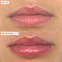 Dr. Whitney Bowe Beauty Tri-Liptide Peptide Lip Enhancing Treatment 15ml