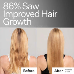 Act+Acre Stem Cell Shampoo for Hair Thinning and Growth 295ml