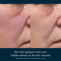 Elemis Dynamic Resurfacing Pads (60 Pads)