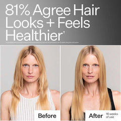 Act+Acre Stem Cell Shampoo for Hair Thinning and Growth 295ml
