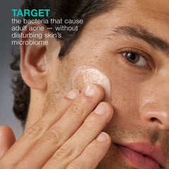 Dermalogica Acne Biotic Moisturizer (1.7 oz)