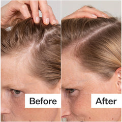 Act+Acre Salicylic Acid Scalp Exfoliator 