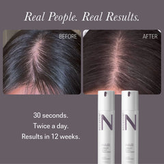 NULASTIN Vibrant Scalp Treatment 1.7 fl oz