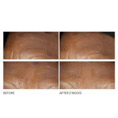 Dr Dennis Gross Advanced Retinol and Ferulic Intense Wrinkle Cream 60ml