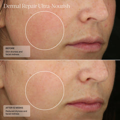 SENTÉ Dermal Repair UltraNourish (1.7 oz.)