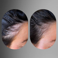 Act+Acre Advanced Fuller Hair System (Worth $186.00)