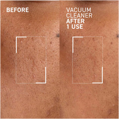 Dr. Brandt Pores No More Vacuum Cleaner 1.0oz