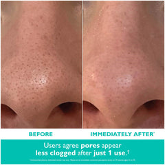 Peter Thomas Roth Even Smoother Microdermabrasion Exfoliating Pore Purifier (1.7 oz)
