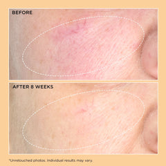 Perricone MD Neuropeptide Pro-Strength Firming Moisturizer