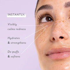 Patchology Skin Remedy Soothing Eye Gels - 5 Pack