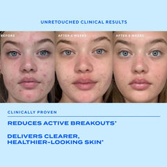 Murad Biome-Balancing Clear & Prevent Acne Treatment Serum 30ml