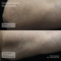 SENTÉ Dermal Repair Body Cream 177ml