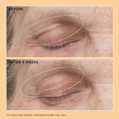 Perricone MD Neuropeptide Eyelid Lift Serum