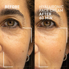 Needles No More Hyaluronic Face Cream 50g