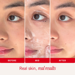 First Aid Beauty Ultra Gentle Cream-to-Foam Cleanser 10 oz