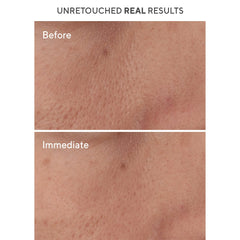 Murad Targeted Pore Corrector 0.5 oz