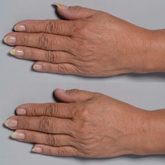Perricone MD Cold Plasma Plus+ Hand Therapy