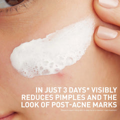 CeraVe Acne Clay To Foam Cleanser For Acne-Prone Skin (4 fl. oz.)