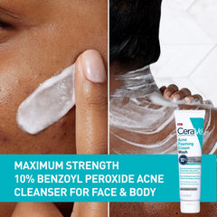 CeraVe Acne Foaming Cream Wash with 10% Benzoyl Peroxide for Face and Body (5 fl. oz.)