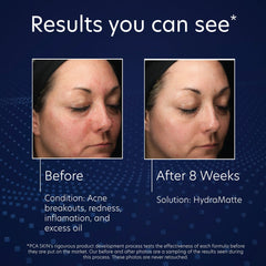 PCA SKIN HydraMatte 53ml
