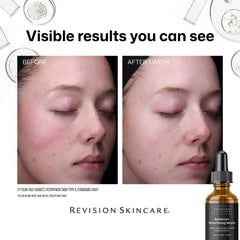 Revision Skincare Radiance+ Resurfacing Serum (1.0 fl. oz.)