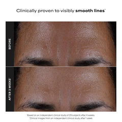 Paula's Choice Skin Perfecting 2% BHA Liquid Exfoliant (118ml)