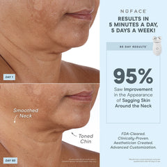 NuFACE Trinity+® Effective Lip & Eye Attachment