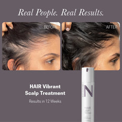 NULASTIN Vibrant Scalp System
