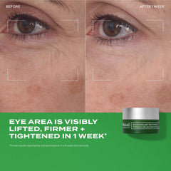 Murad Retinal ReSculpt Eye Treatment 0.5oz