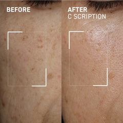 Dr. Brandt C Scription 30ml