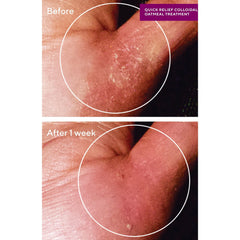 Murad Sensitive Skin Quick Relief Colloidal Oatmeal Treatment 50ml