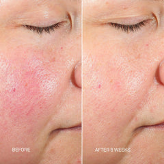 RescueMD DNA Repair Complex 30ml