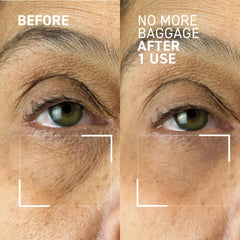 Dr. Brandt Needles No More No More Baggage Eye Gel 15g