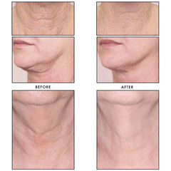 Revision Skincare® Nectifirm 1.7 oz.
