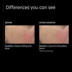 PCA SKIN C-Quench Antioxidant Serum (1 oz.)