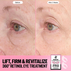 Peace Out Retinol 360° Eye Lift Patches to Lift, Firm and Revitalize Eyes (5 Pairs)