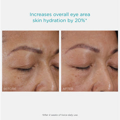 Neostrata RESTORE Hydra Filling PHA Eye Cream 0.5 oz