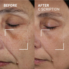 Dr. Brandt C Scription 30ml
