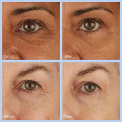 skyn ICELAND Hydro Cool Firming Eye Gels (16-pack)